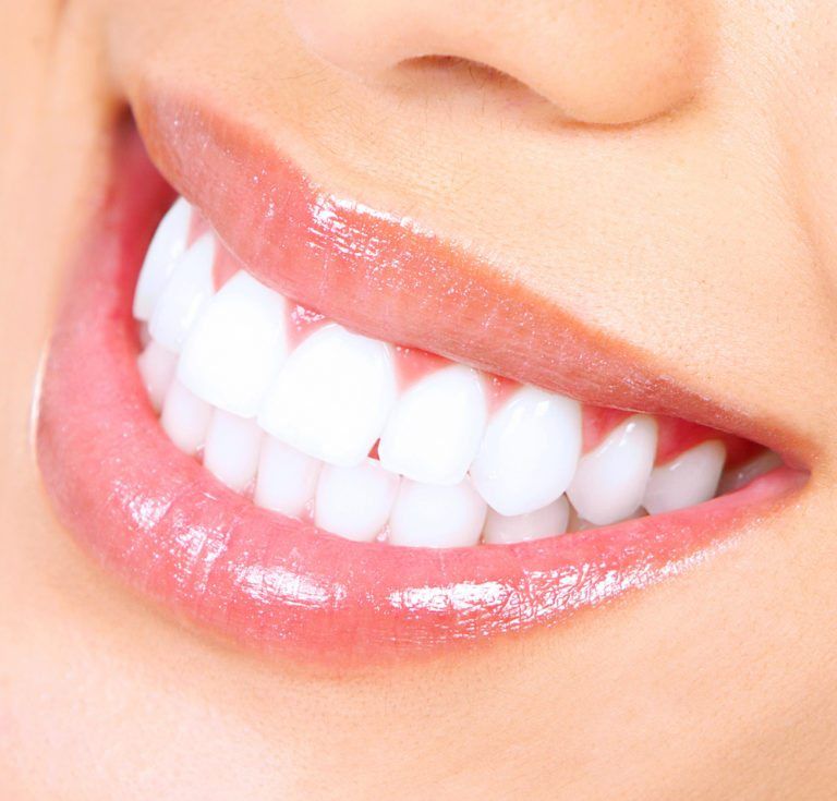 Close up image of a woman's smile, with white teeth