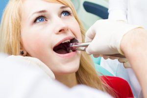 Close up image of woman seated on a dental chair with a dentist using a tooth extraction tool in patients mouth